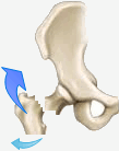 fracture col femur  2